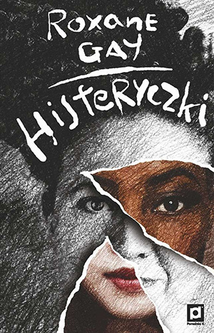 histeryczki b iext115638595